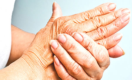 Artritis en ancianos