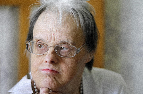 Ancianos con sindrome de down