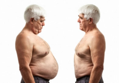 Sobrepeso en personas mayores y demencia